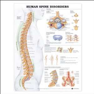  Human Spine Disorders Anatomical Chart 20 x 26 Health 