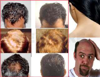 Laser Treatment Hair Loss Stop Regrow By Power Comb Kit  