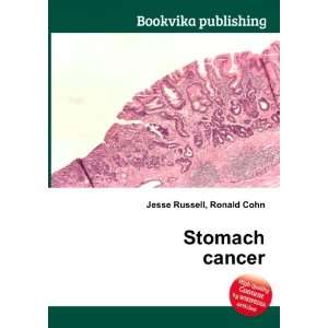  Stomach cancer Ronald Cohn Jesse Russell Books