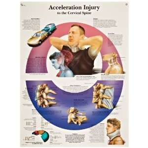   Injury To The Cervical Spine Anatomical Chart, Poster Size 20 Width x